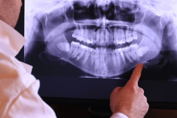Best Emergency Dental Services for Seniors in Jasper, GA